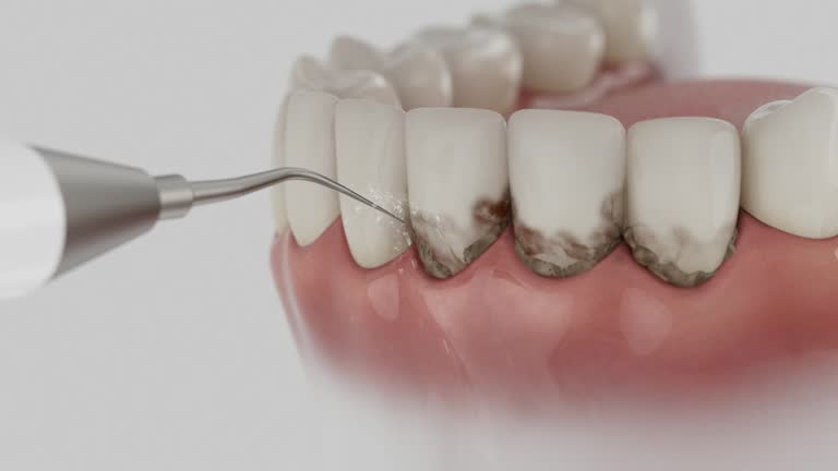 Reliable Invisalign Clear Aligners contractor in Baltimore city County, MD by Dentist Open Now